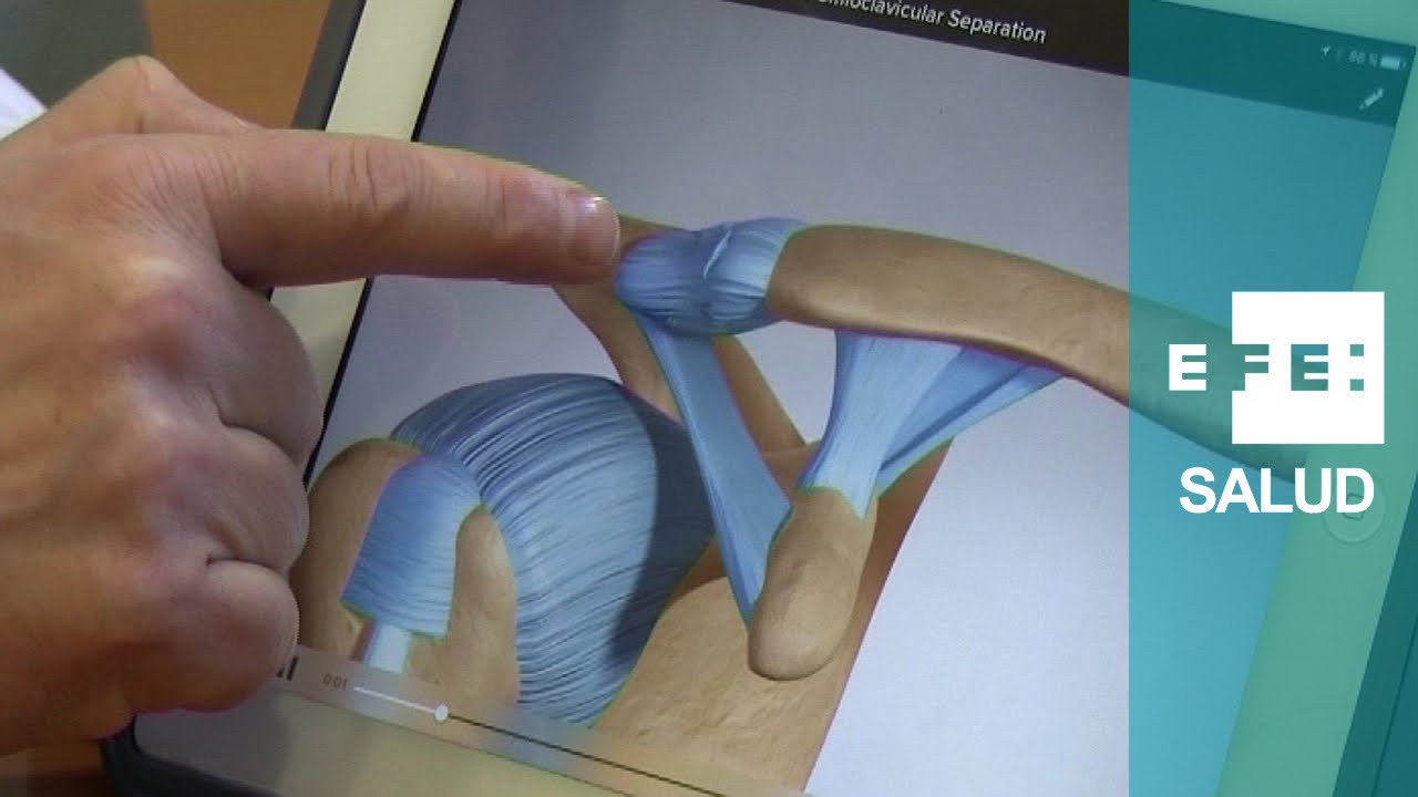 dolor arriba de la clavicula izquierda