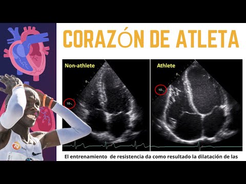 el entrenamiento de resistencia aumenta el tamaño del corazon