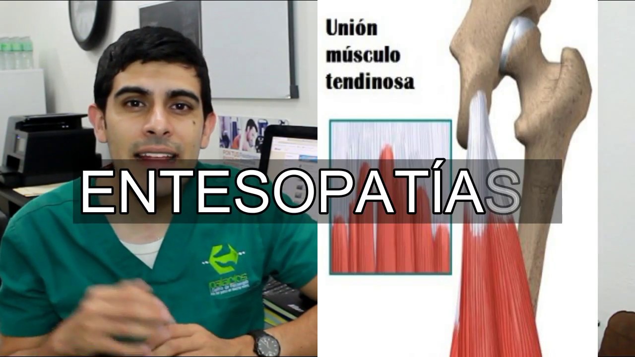 entesopatia insercional del tendon de aquiles
