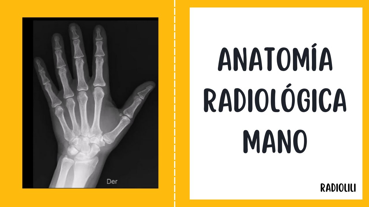 huesos de la mano derecha radiografia