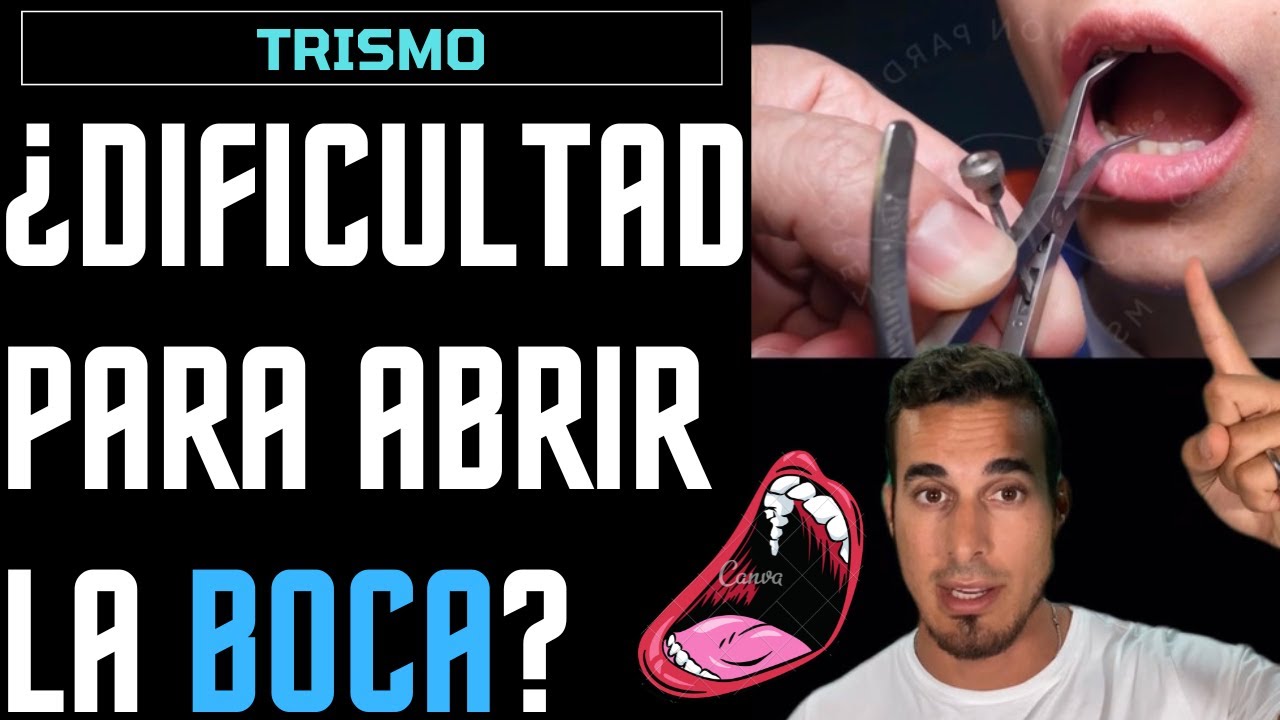 no puedo abrir la boca mas de dos dedos