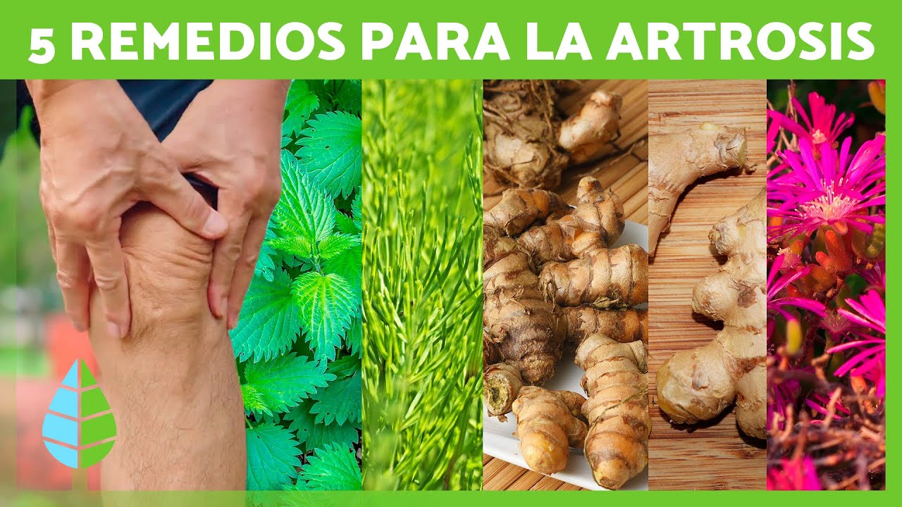 productos naturales para la artrosis degenerativa
