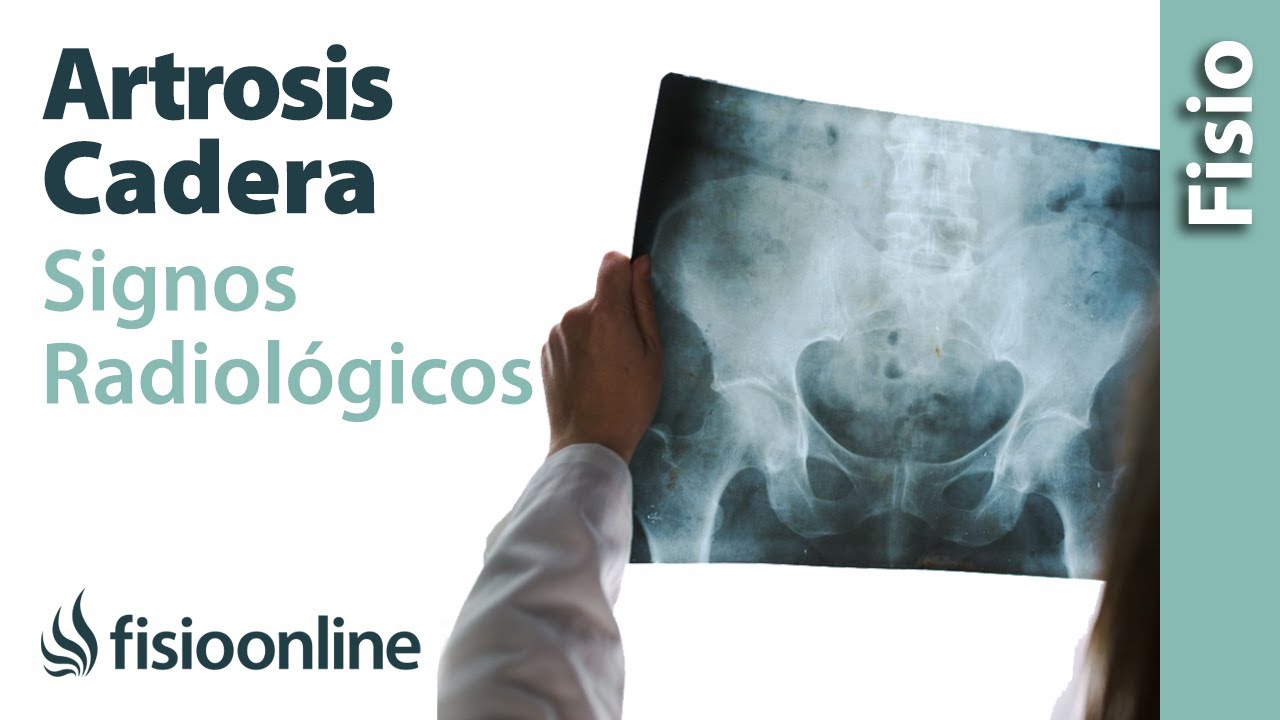 que se ve en una radiografia de cadera
