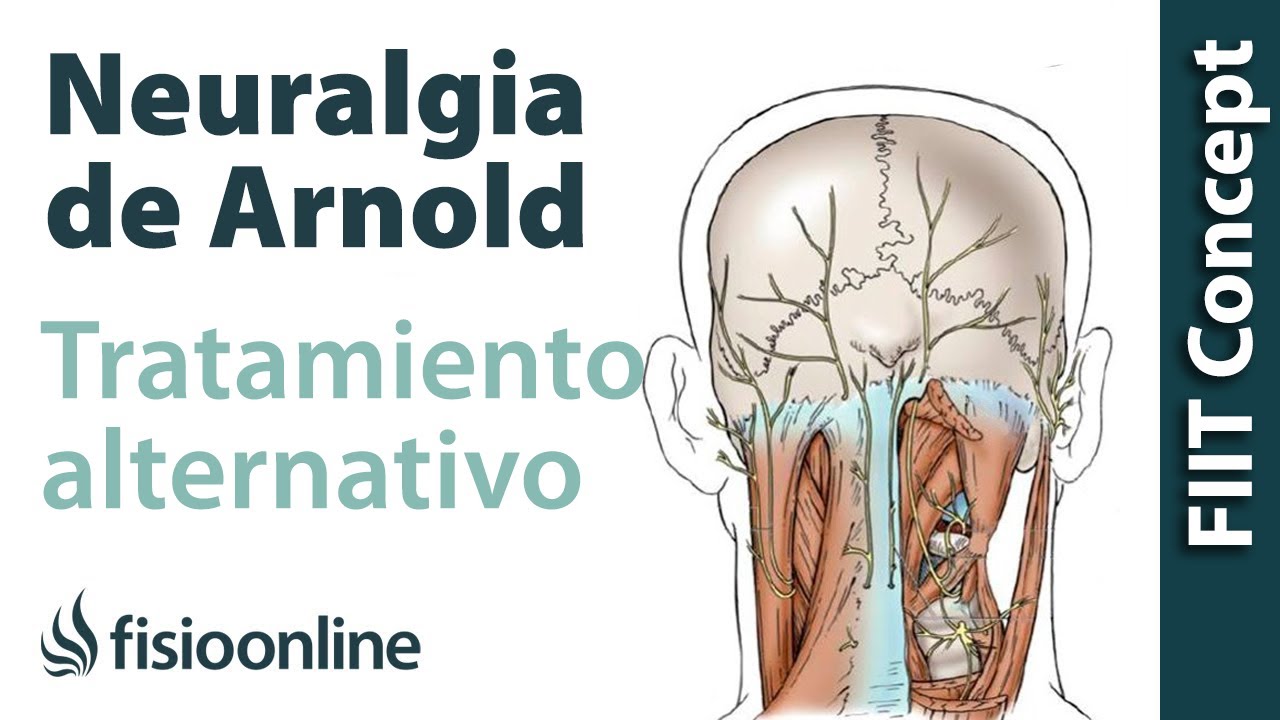 remedios naturales para la neuritis intercostal