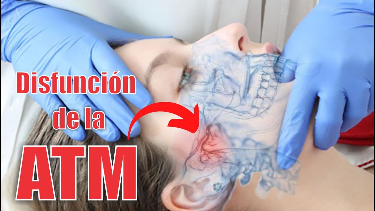 síndrome de disfunción de la articulación temporomandibular