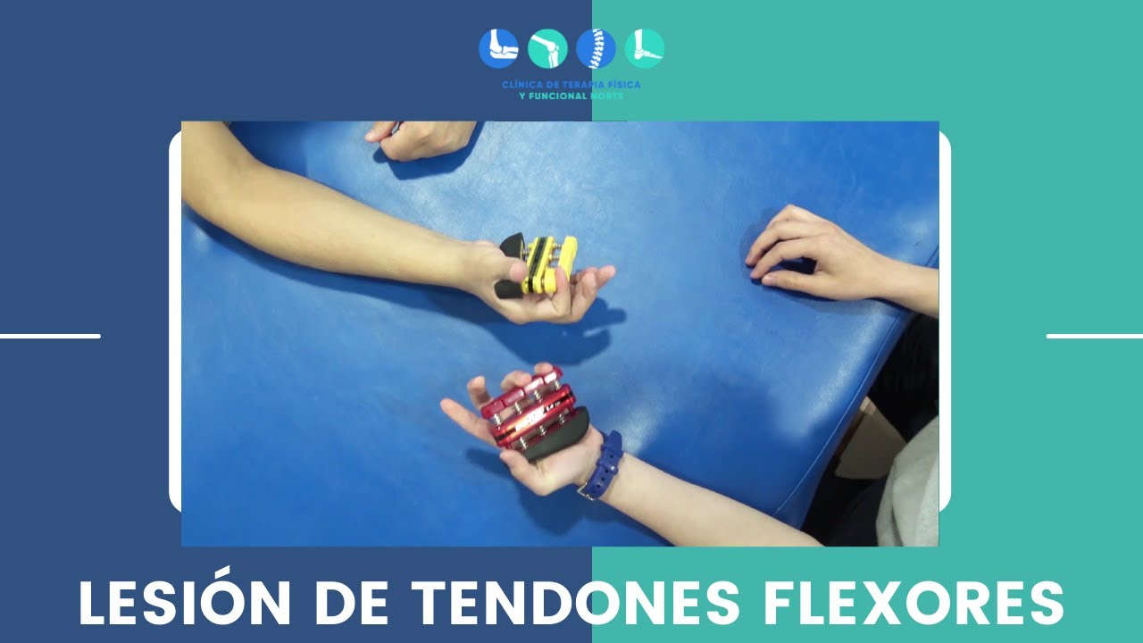 tendinitis en los flexores de la mano