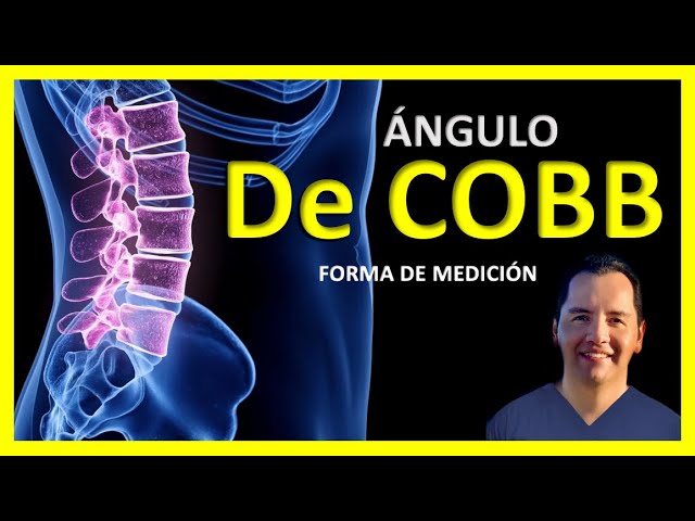 angulo de cobb como se mide