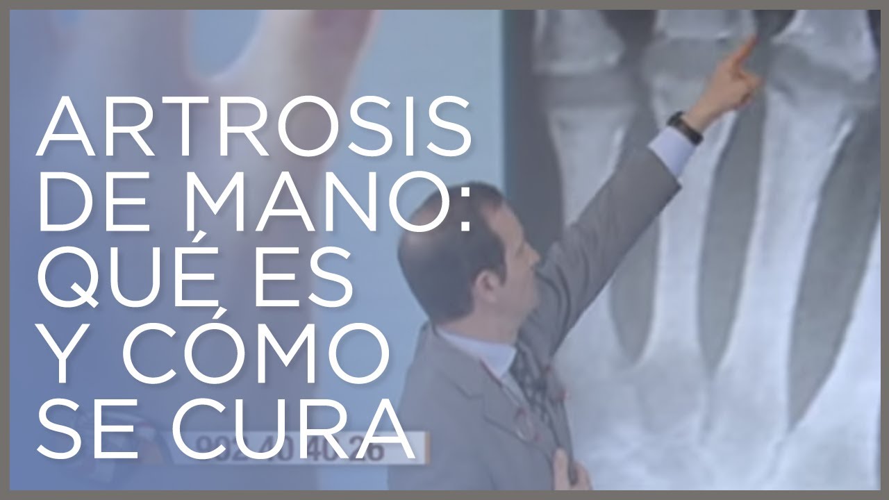 artrosis en los dedos dela mano sintomas