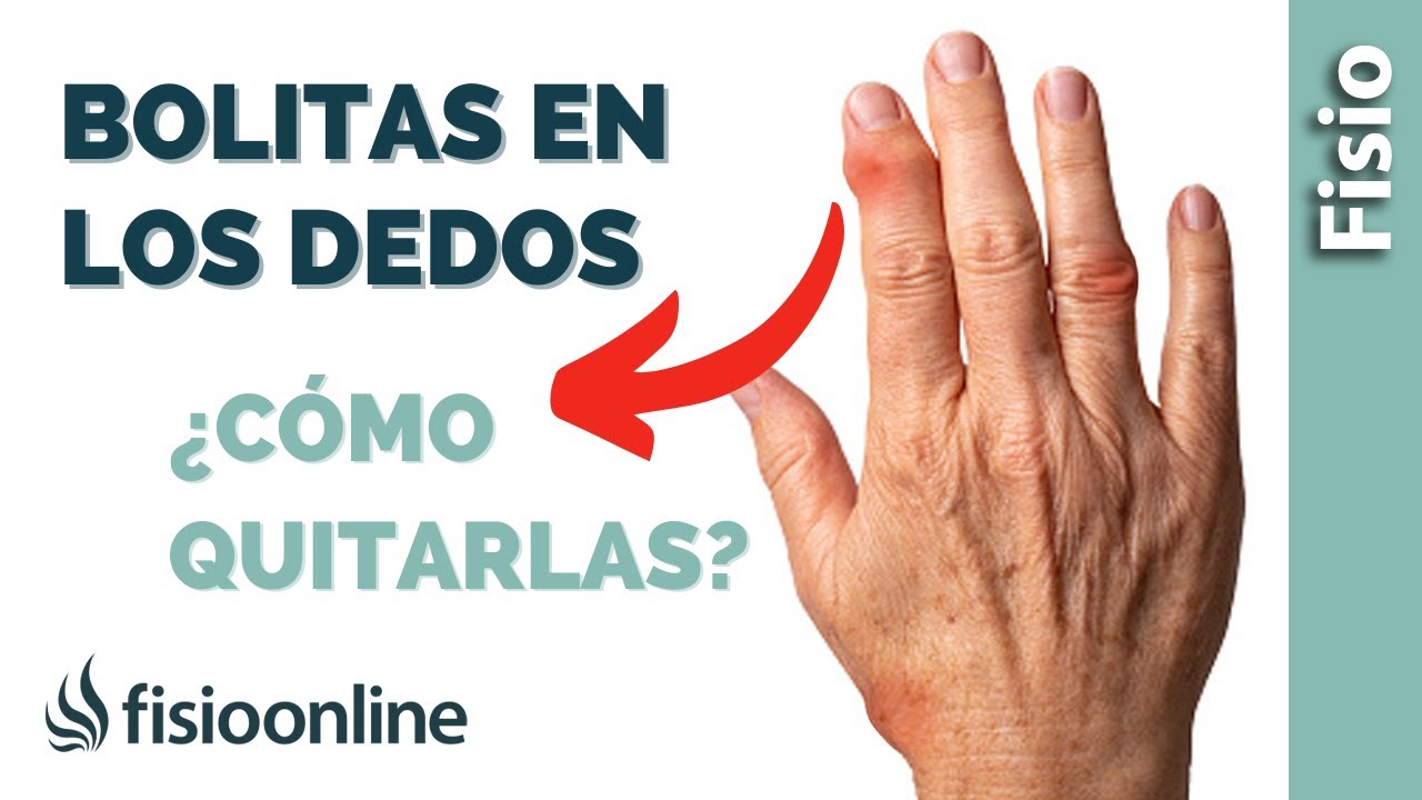 bolita en el dedo indice dela mano