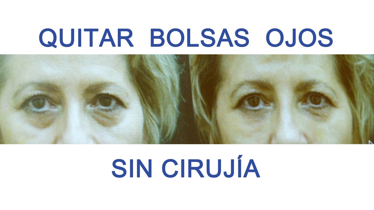 bolsas en los ojos sin cirugia