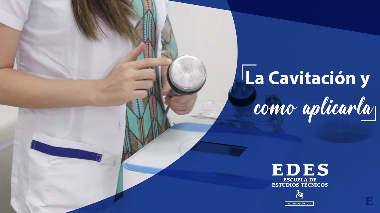 cavitacion que es y como funciona