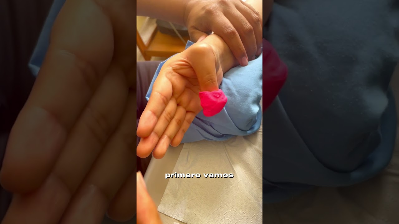 como curar una tendinitis en el dedo pulgar