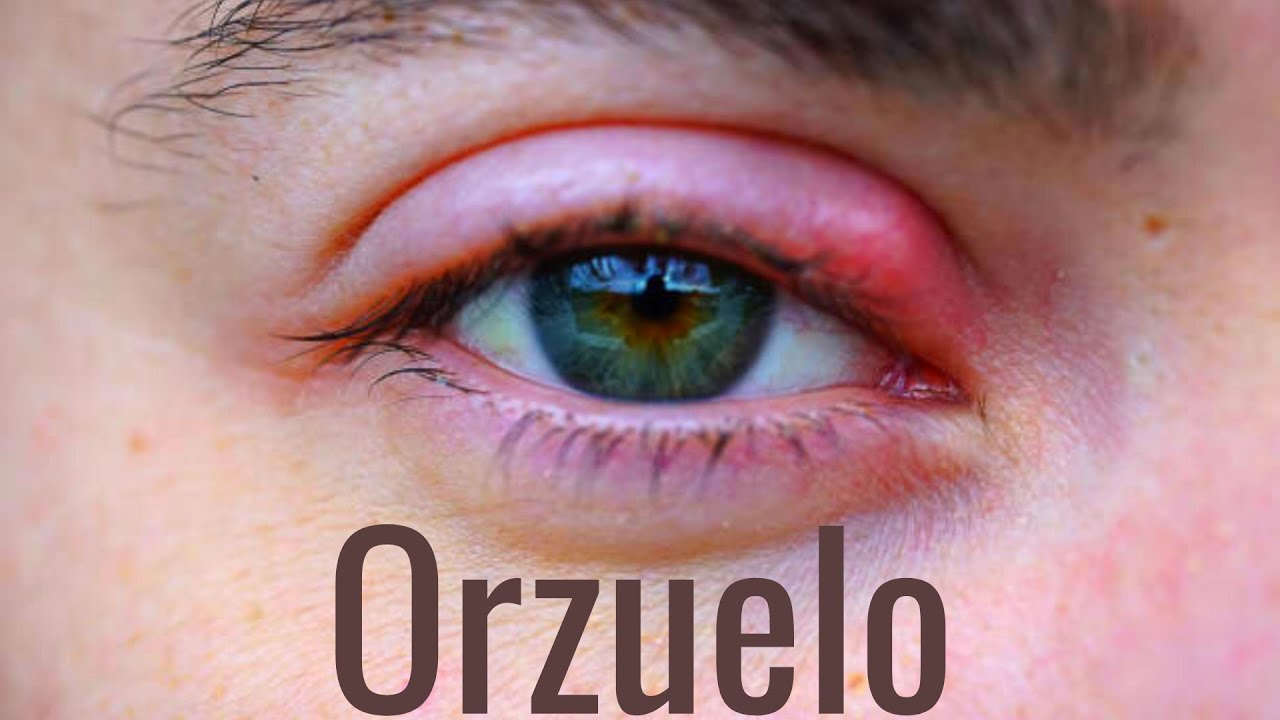 como quitar bolitas de los ojos
