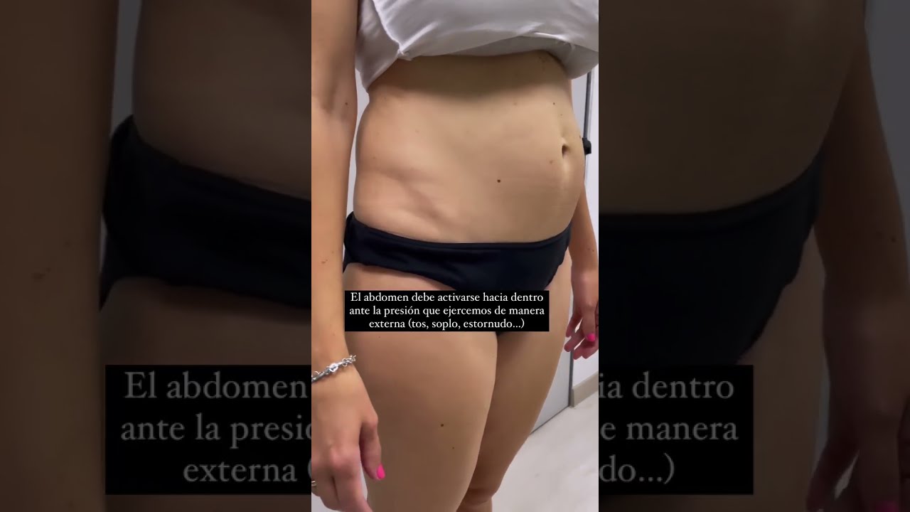 como recuperar la barriga despues de una cesarea