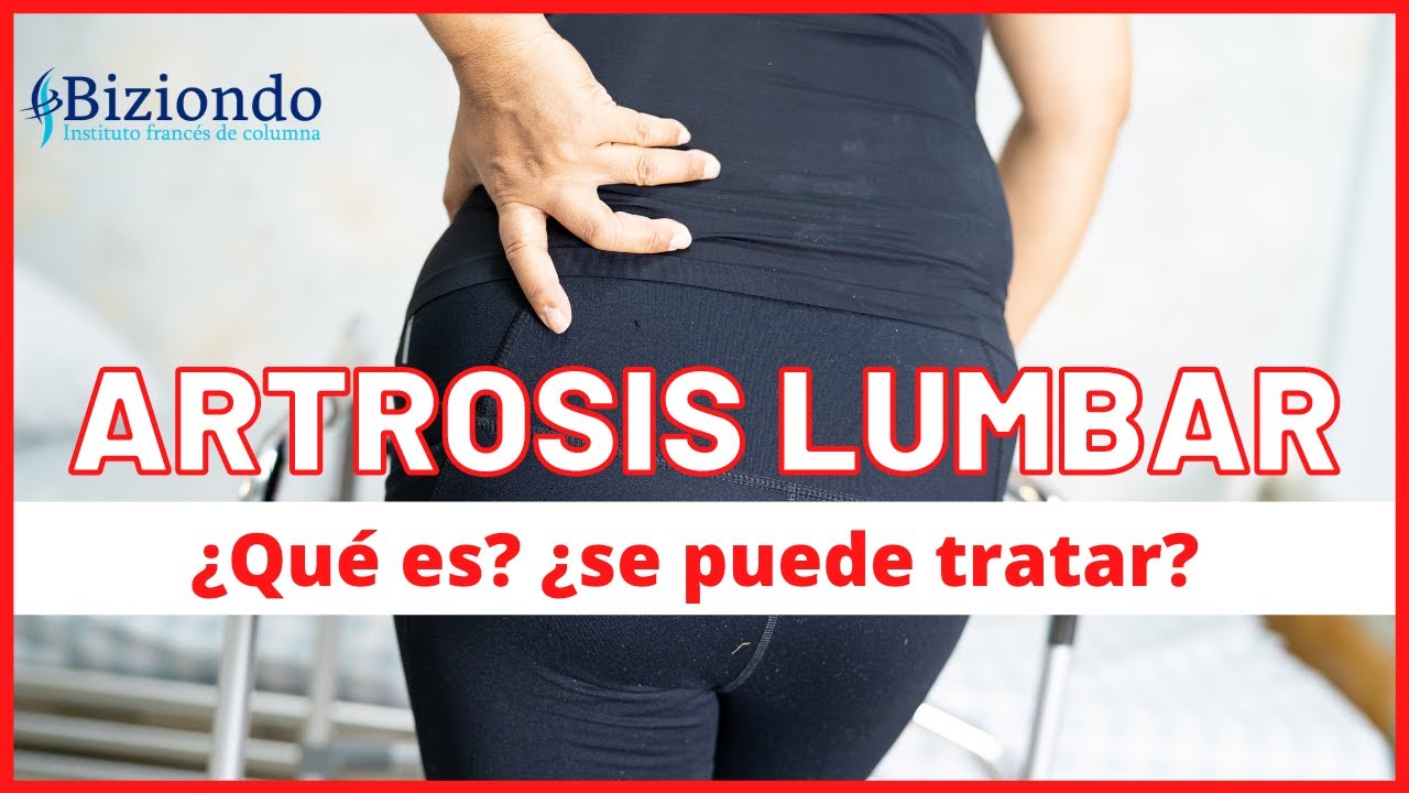 como tratar la artrosis en la columna