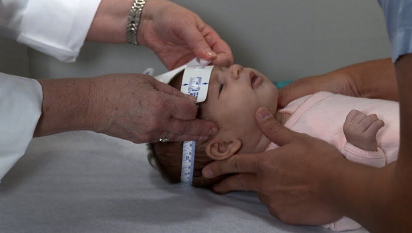 cuanto mide el craneo de un bebe