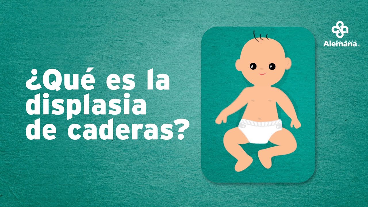 displasia de cadera tratamiento con yeso