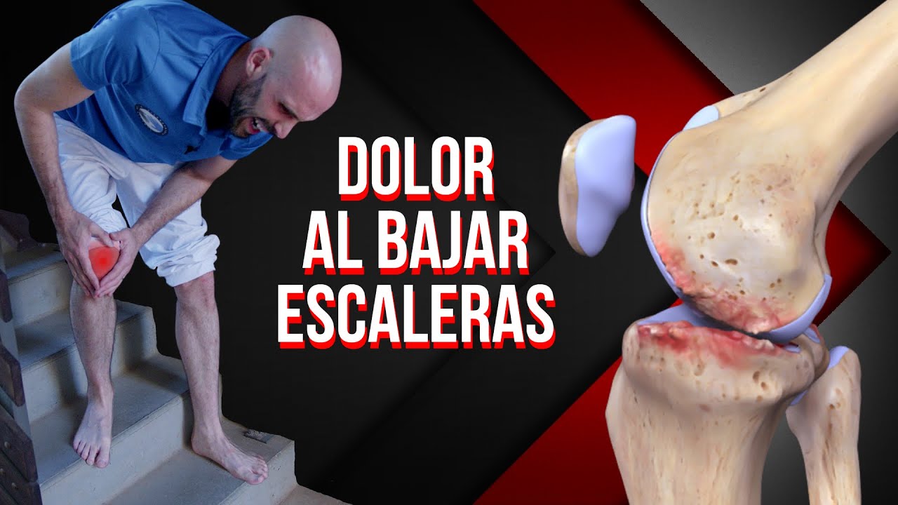 dolor de rodilla al correr y bajar escaleras