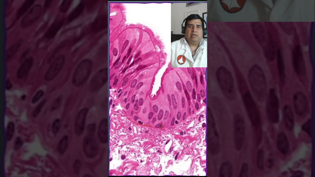 donde se encuentra la membrana basal