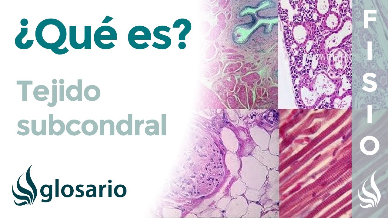 esclerosis subcondral de los platillos vertebrales