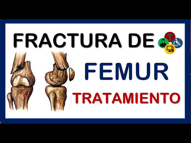 fractura del tercio distal del femur