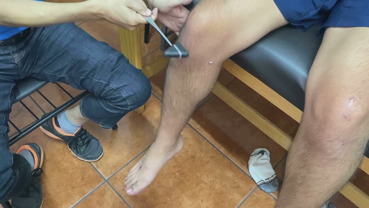 no tengo reflejos en las rodillas