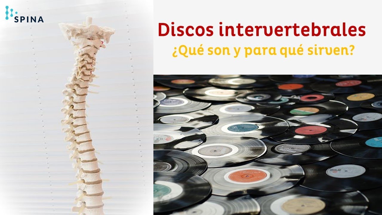 para que sirven los discos intervertebrales