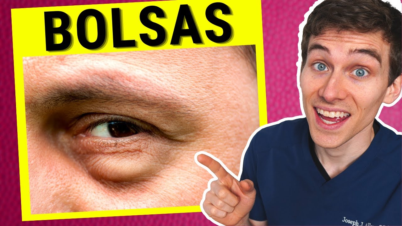 producto para eliminar bolsas en los ojos