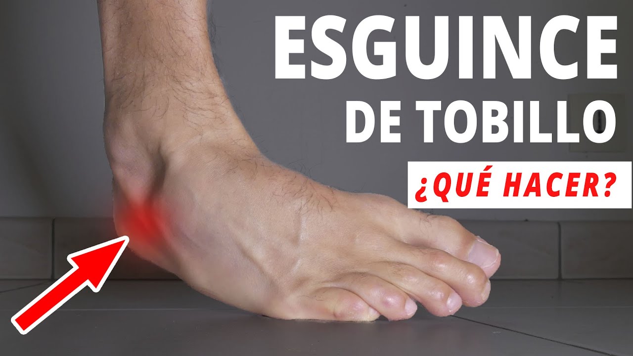 que es bueno para los golpes en el pie