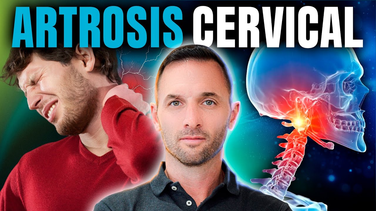 que tomar para la artrosis cervical