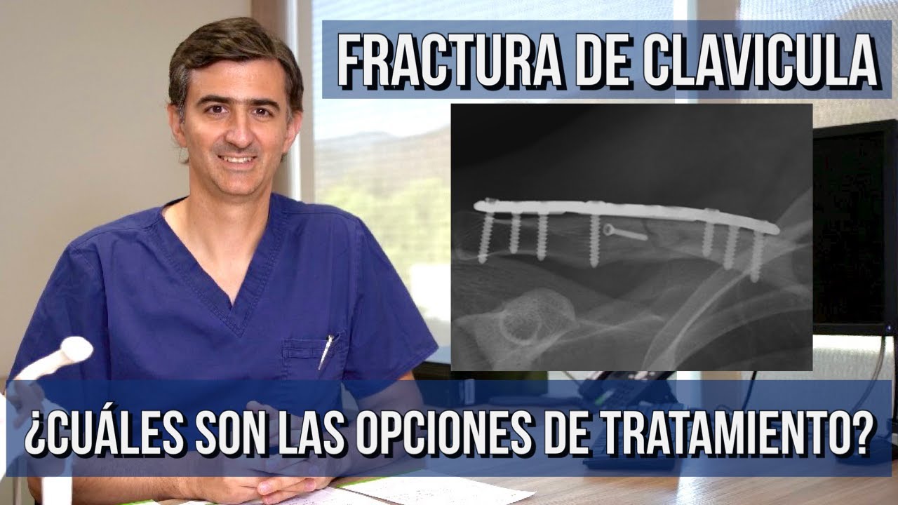 se puede conducir con la clavicula rota