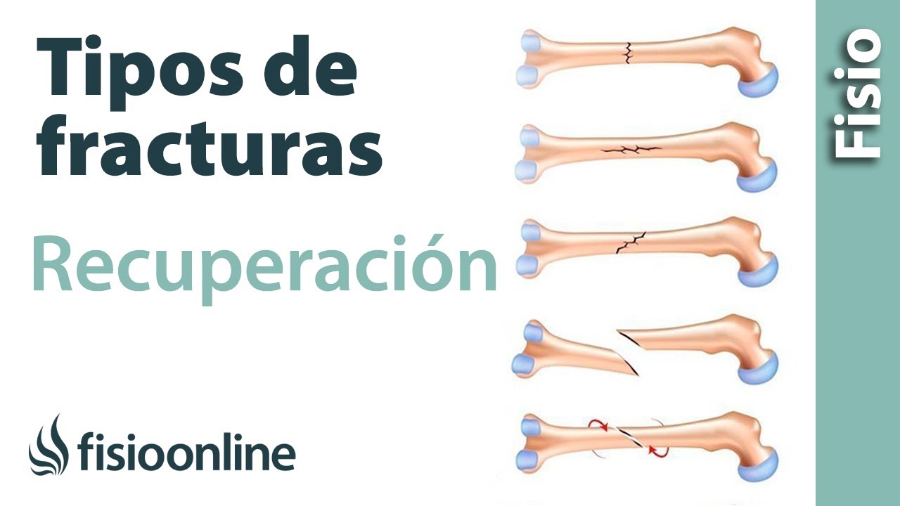 tipos de lesiones en los huesos
