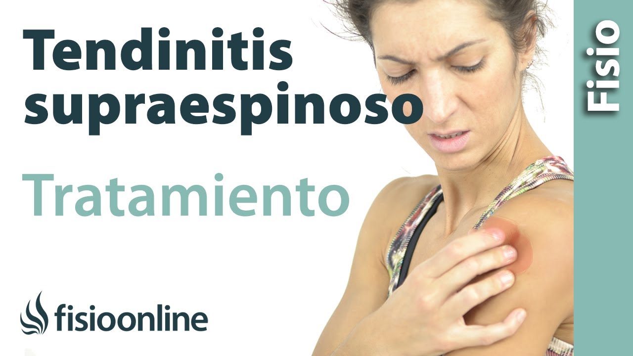 tratamiento de la tendinitis del supraespinoso