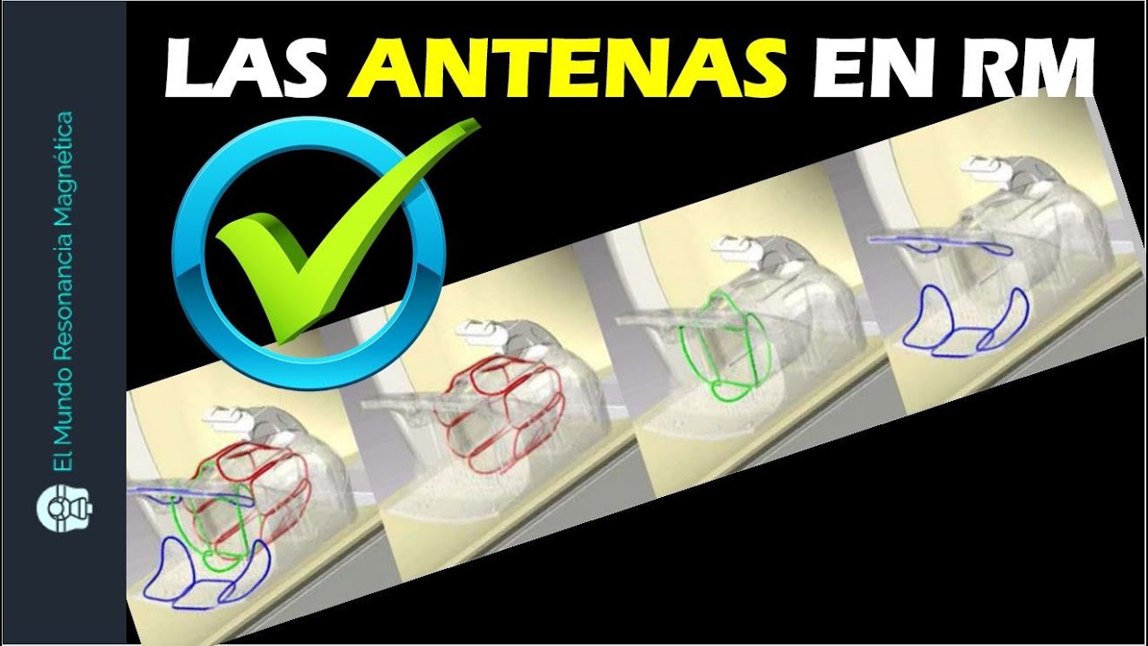 bobinas de radiofrecuencia en resonancia magnetica