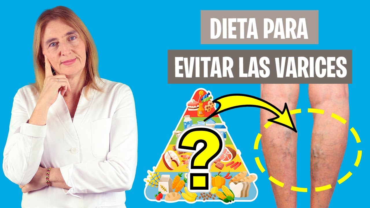 dieta de las tres semanas varices