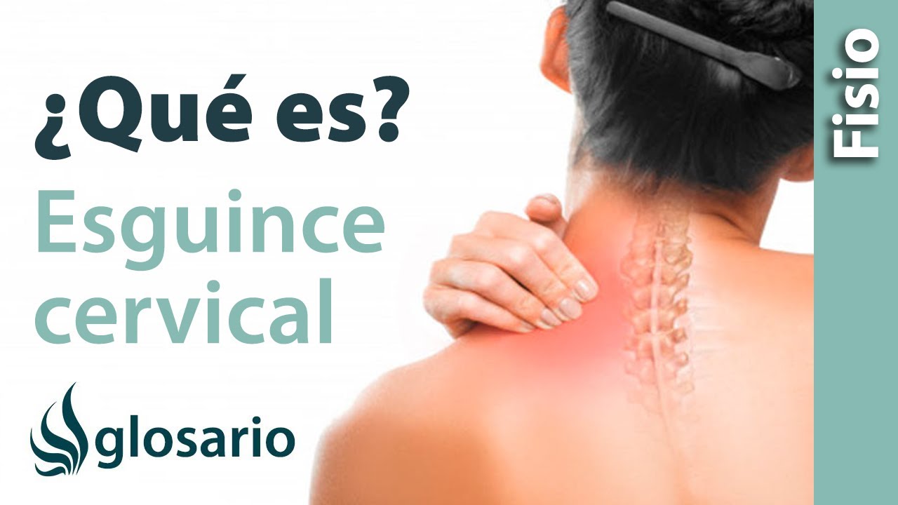 diferencia entre cervicalgia y esguince cervical