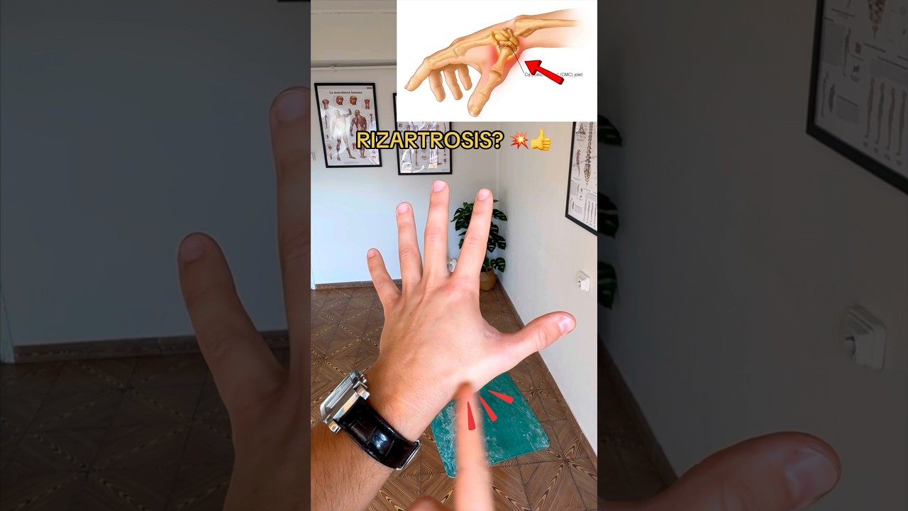 dolor en la base del pulgar