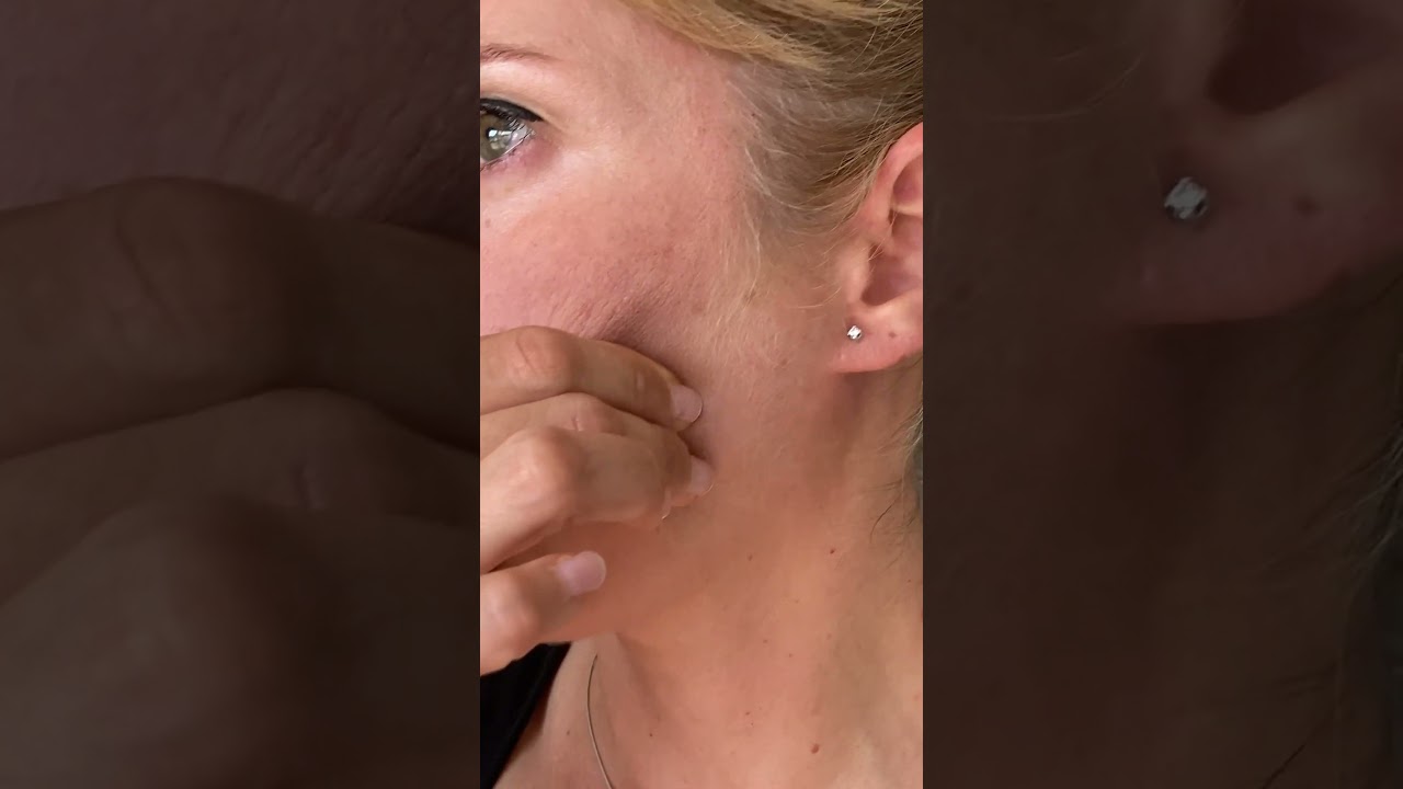 hinchazon en mandibula debajo de la oreja