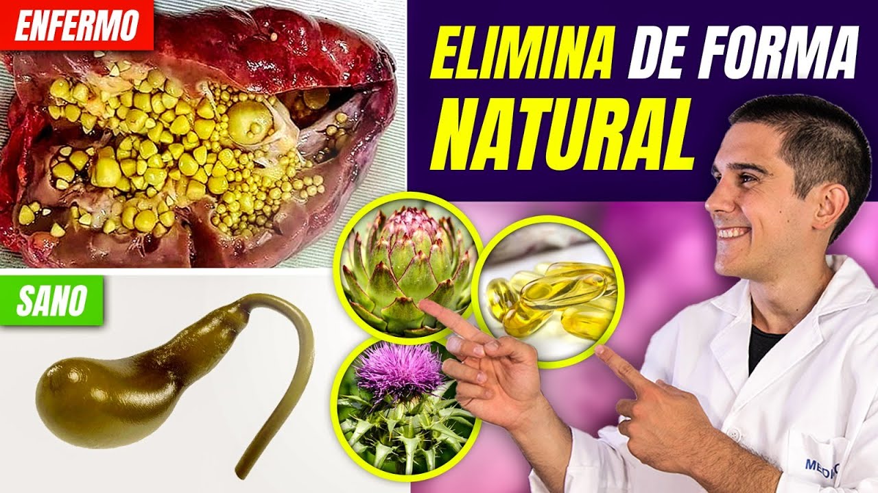 limpieza de piedras en la vesicula