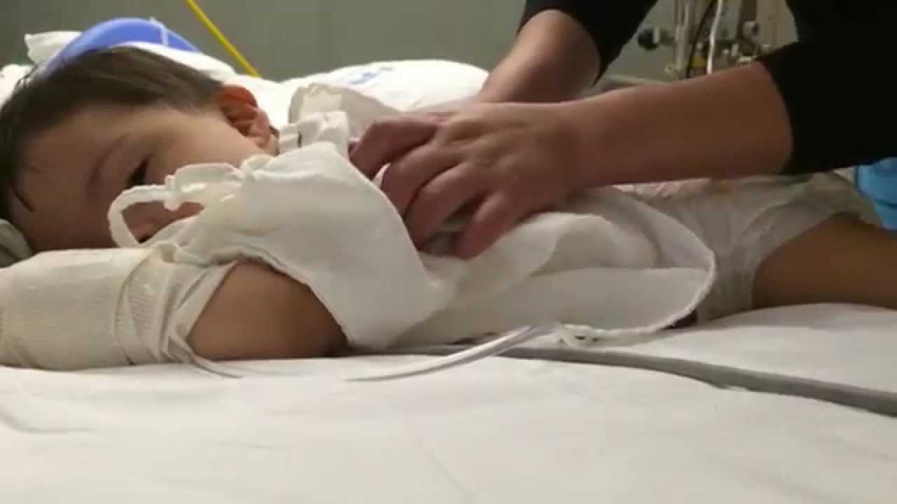 palmadas en la espalda para la tos