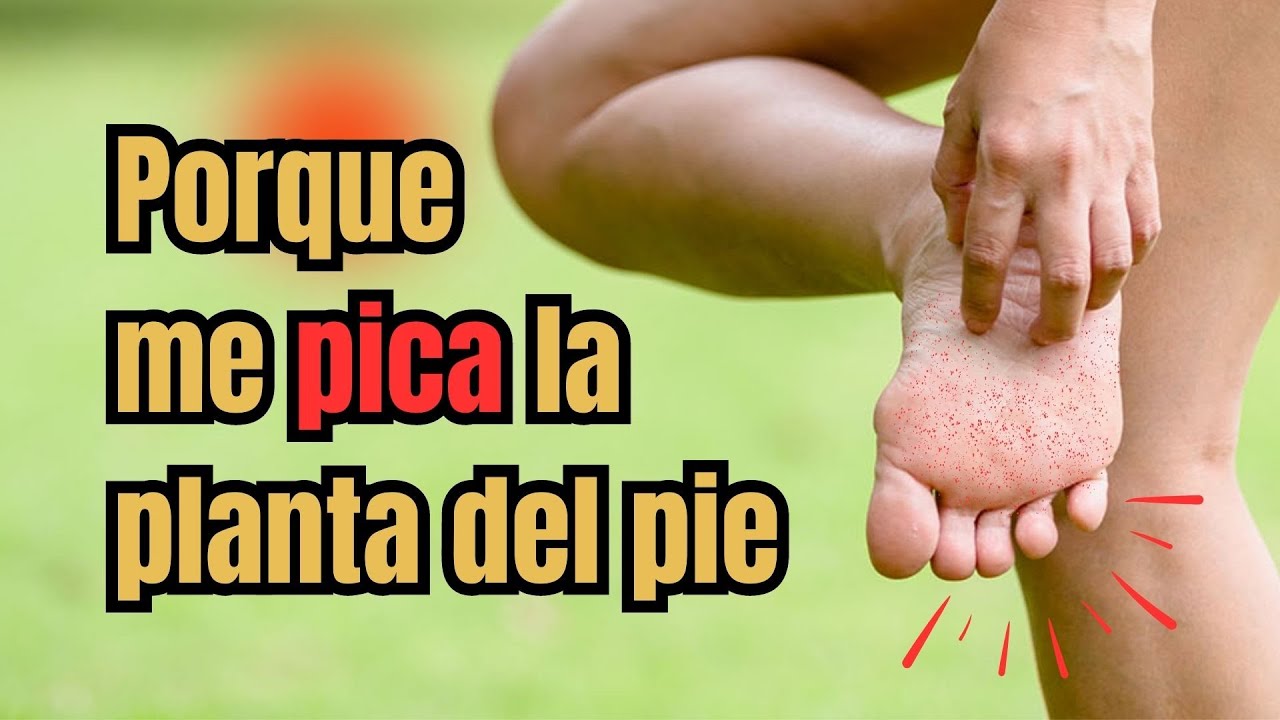 si te pica la planta del pie