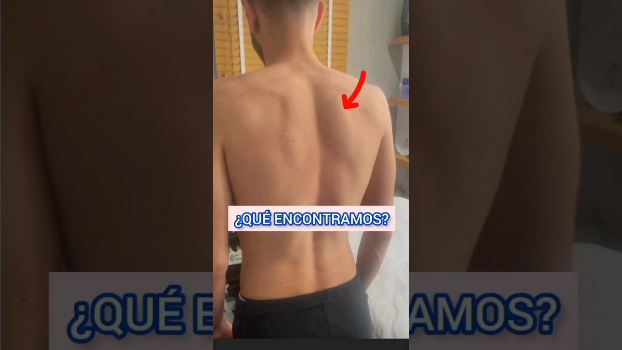 tengo escoliosis y me cuesta respirar