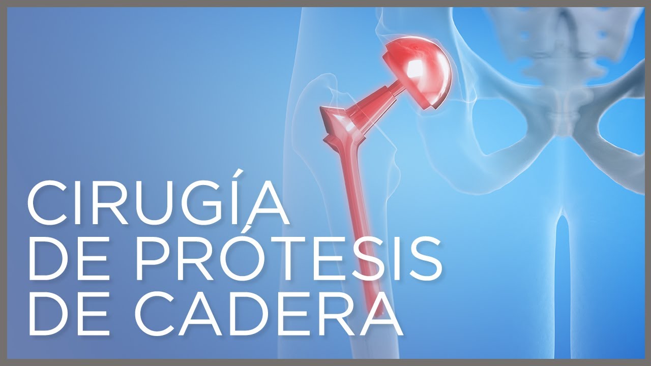 tiempo de recuperacion protesis de cadera