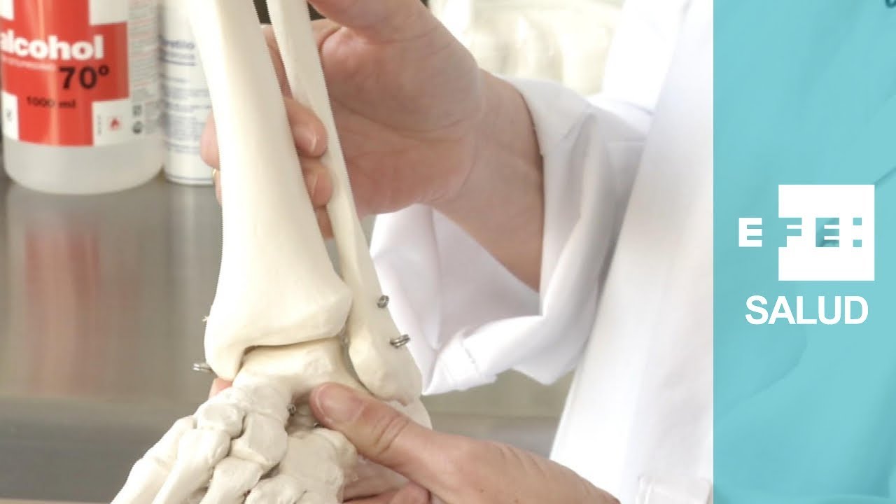 tiempo en curar una rotura de peroné