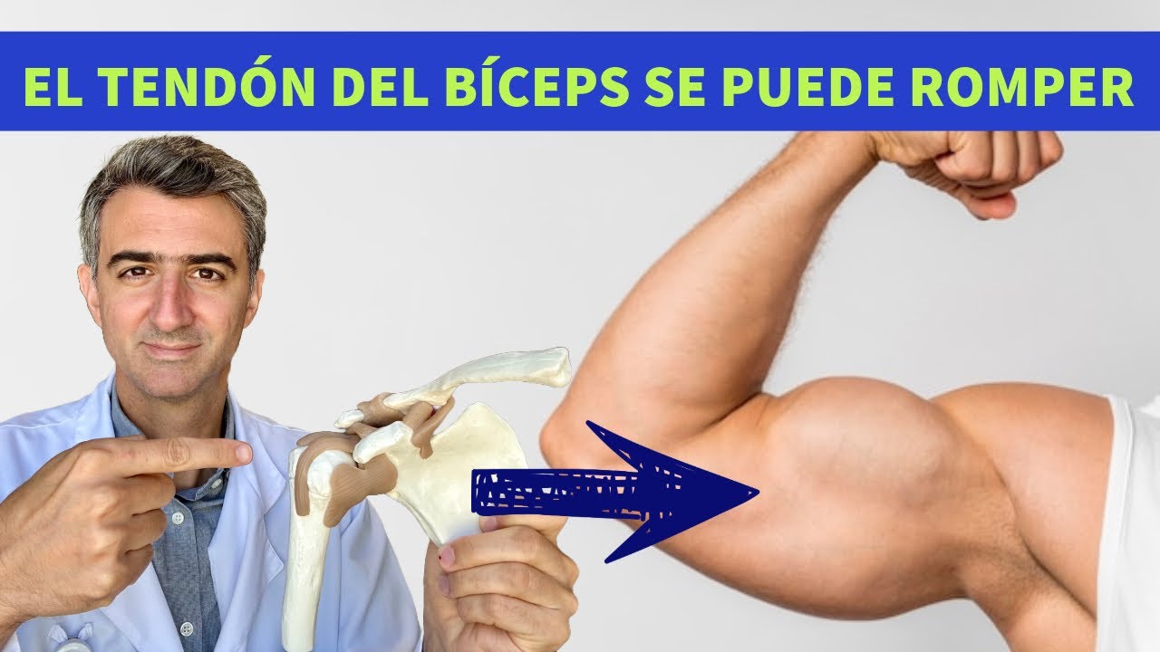 dolor en el biceps del brazo izquierdo