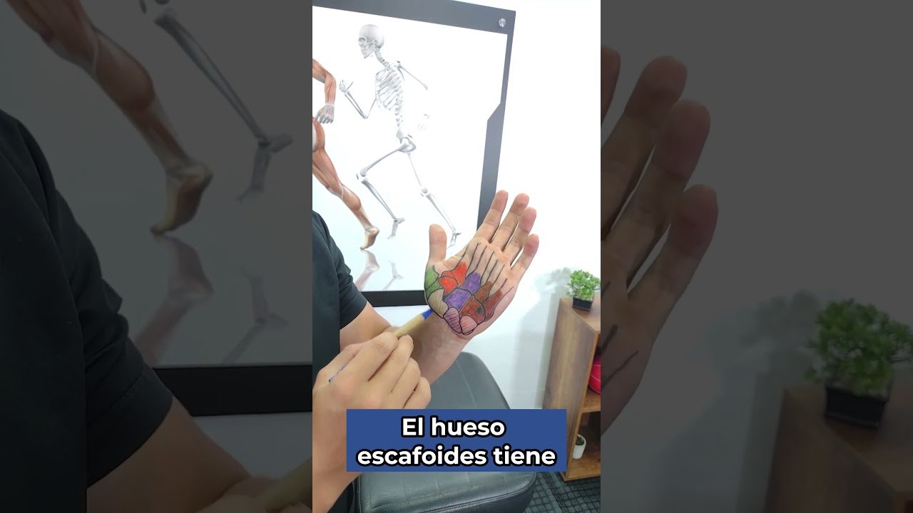 dolor en los huesos metacarpianos de la mano
