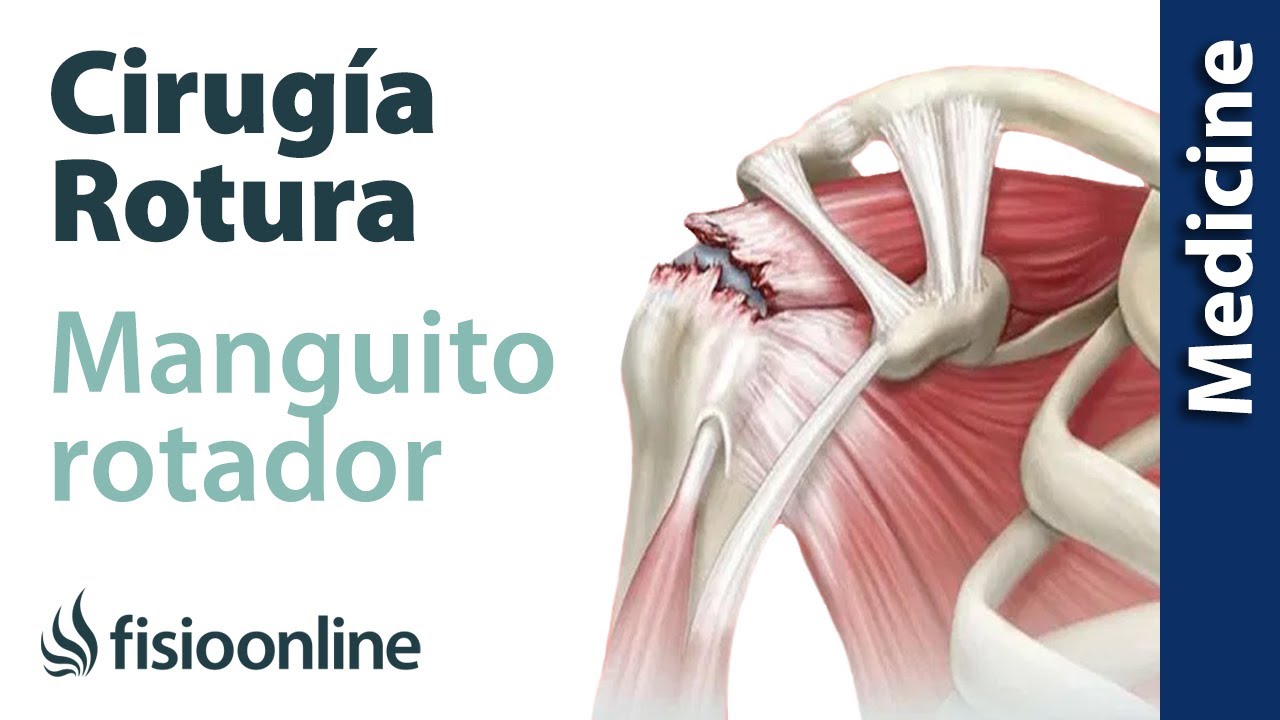 fisiopatologia de tendinitis del manguito rotador