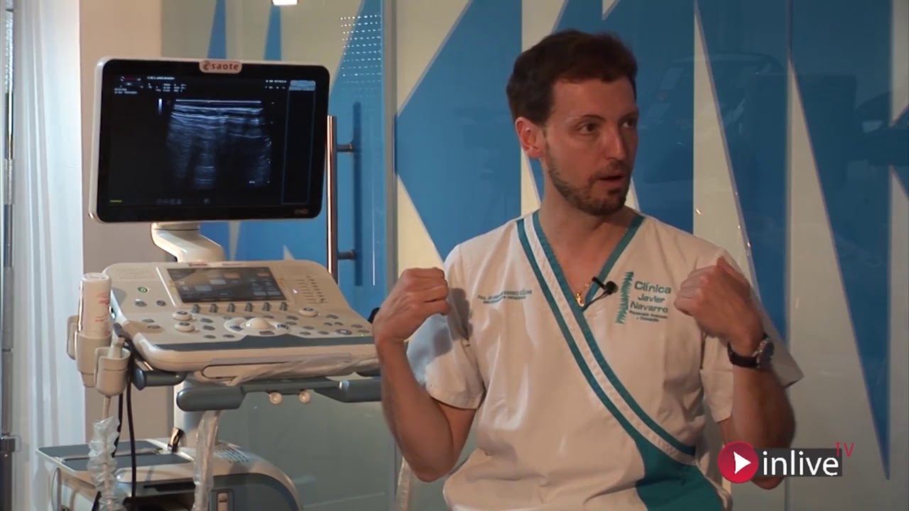 hernia de hiato sintomas y dolor de espalda