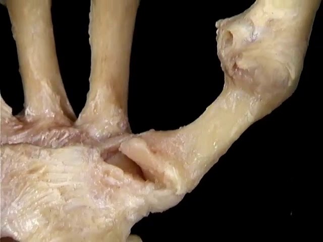 huesos del dedo gordo de la mano