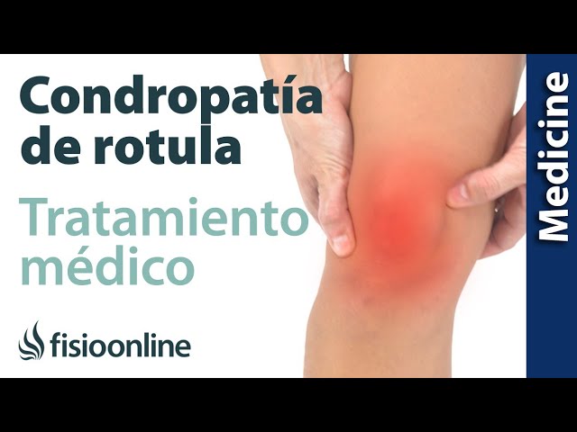 la condromalacia rotuliana es una artrosis